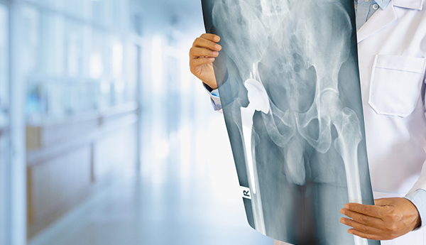 Benefits of Robotic Hip Replacement: Insights from Research and Data